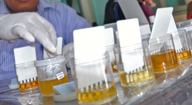 Test Urine Permintaan Kalapas