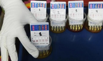 Dirazia, 4 Napi di Lapas Kupang Positif Narkoba