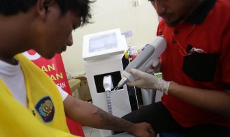 Hijrah Total, Narapidana Nusakambangan Ramai-Ramai Hapus Tato