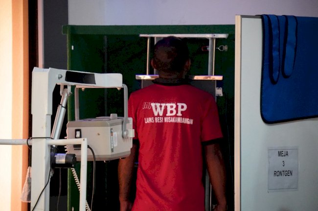 Gerak Cepat Cegah TBC, 488 Warga Binaan Lapas Besi Jalani Skrining Rontgen