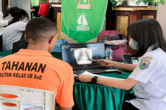 Rutan SoE Gelar CKG dan Skrining TBC, 220 Orang Jalani Pemeriksaan